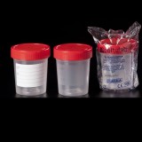 Pots plàstic PP tap rosca estèrils-A 150 ml D-409726. Capsa 350 unitats