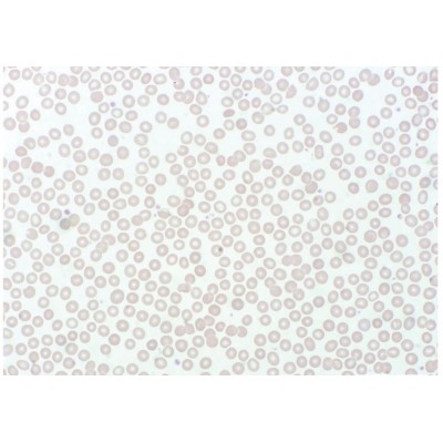 Preparación microscópica Jeulin LN-575406. Sangre humana