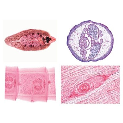 Preparacions microscòpiques L-3900 (50p). Parasitisme complet