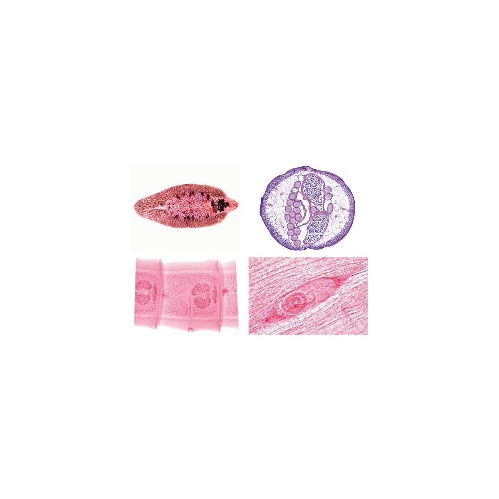 Preparacions microscòpiques L-3900 (50p). Parasitisme complet