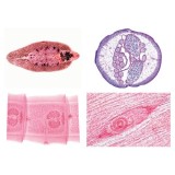 Preparacions microscòpiques L-3900 (50p). Parasitisme complet