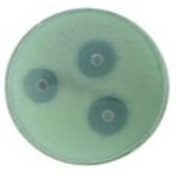 Microbial identification